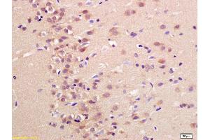Formalin-fixed and paraffin embedded rat brain labeled with Anti-Neuritin Polyclonal Antibody, Unconjugated (ABIN740655) at 1:200 followed by conjugation to the secondary antibody and DAB staining (NRN1 anticorps  (AA 51-142))