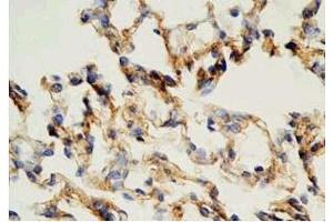 Rat lung tissue was stained by Rabbit Anti-AdrenomeduIIiln (1-44) (Human) Antibody (Adrenomedullin anticorps  (AA 1-44))