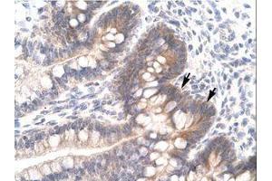 Image no. 1 for anti-FOS-Like Antigen 2 (FOSL2) (AA 208-256) antibody (ABIN6735784)