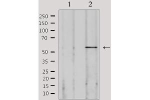 Western blot analysis of extracts from 293, using SPAM1 Antibody.
