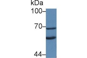 Detection of KL in Rat Liver lysate using Polyclonal Antibody to Klotho (KL) (Klotho anticorps  (AA 517-956))