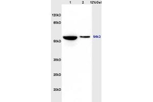Lane 1: rat heart lysates Lane 2: rat brain lysates probed with Anti phospho-GSK3 Alpha(Ser21) Polyclonal Antibody, Unconjugated (ABIN708116) at 1:200 in 4 °C.