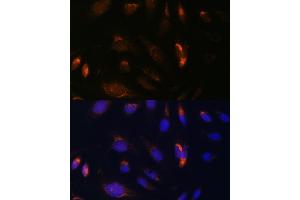 Immunofluorescence analysis of U-2 OS cells using CHUK antibody (ABIN3022824, ABIN3022825, ABIN3022826 and ABIN6219246) at dilution of 1:100. (IKK alpha anticorps  (C-Term))
