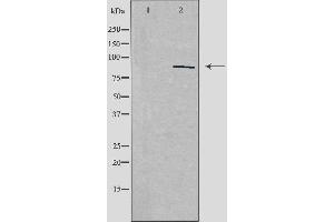 Western blot analysis of extracts from HepG2 cells, using ZNF148 antibody. (ZNF148 anticorps  (N-Term))