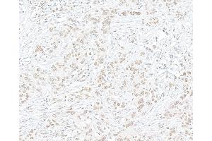 Immunohistochemistry (IHC) image for anti-Enhancer of Zeste Homolog 2 (EZH2) (C-Term) antibody (ABIN7795724) (Recombinant EZH2 anticorps  (C-Term))