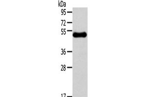 Western Blot analysis of Human breast infiltRative duct tissue using RHCE Polyclonal Antibody at dilution of 1/250 (RHCE anticorps)