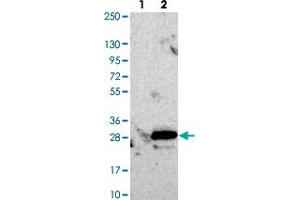 Western blot analysis of Lane 1: Negative control (vector only transfected HEK293T lysate). (RCL anticorps)