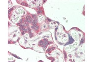 Formalin-fixed and paraffin-embedded H.