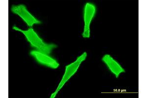 Immunofluorescence of monoclonal antibody to GUCY2D on HeLa cell. (GUCY2D anticorps  (AA 521-630))
