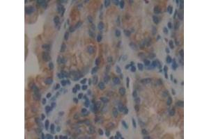 Figure. (LGALS9B anticorps  (AA 228-355))