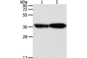 Western Blot analysis of Human leiomyosarcoma and Mouse testis tissue using TPM2 Polyclonal Antibody at dilution of 1:1000 (TPM2 anticorps)