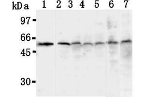 Western Blotting (WB) image for anti-Thioredoxin Interacting Protein (TXNIP) antibody (ABIN567793)