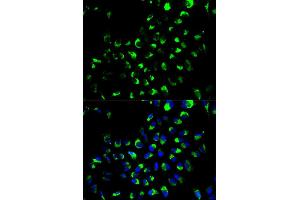 Immunofluorescence analysis of A549 cell using AK4 antibody. (AK4 anticorps)