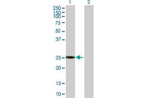 Western Blot analysis of GSTZ1 expression in transfected 293T cell line by GSTZ1 MaxPab polyclonal antibody. (GSTZ1 anticorps  (AA 1-216))