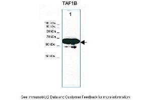Lanes:   30ug NIH3T3 cell lysate  Primary Antibody Dilution:   1:1000  Secondary Antibody:   Anti-rabbit HRP  Secondary Antibody Dilution:   1:5000  Gene Name:   TAF1B  Submitted by:   Thomas Moss