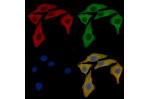Annexin A2 Mouse Monoclonal Antibody staining HepG2 cells by IF/ICC.