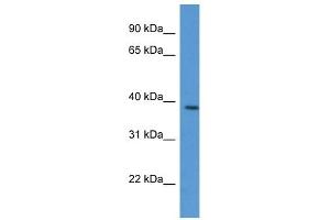 Western Blot showing VASP antibody used at a concentration of 1 ug/ml against Jurkat Cell Lysate (VASP anticorps  (C-Term))