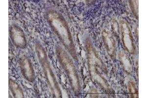 Immunoperoxidase of monoclonal antibody to DHODH on formalin-fixed paraffin-embedded human stomach.