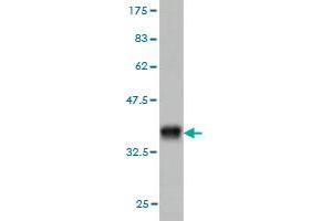 Western Blot detection against Immunogen (35. (Neural Wiskott-Aldrich syndrome protein (WASL) (AA 97-184) anticorps)