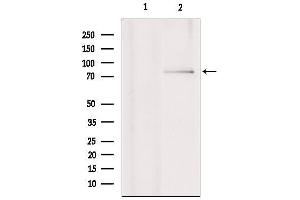 Western blot analysis of extracts from various samples, using RNF6 Antibody. (RNF6 anticorps  (Internal Region))