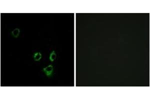 Immunofluorescence analysis of MCF7 cells, using OR2T5/2T29 Antibody.