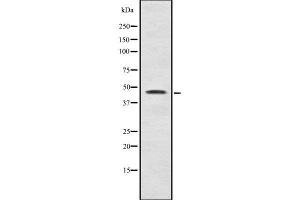 Western blot analysis Sox-11 using LOVO whole cell lysates (SOX11 anticorps  (C-Term))