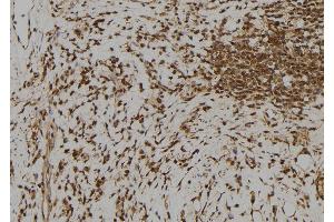 ABIN6273385 at 1/100 staining Human gastric tissue by IHC-P. (RFPL1 anticorps  (Internal Region))