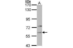 Phenylalanyl-tRNA Synthetase, alpha Subunit (FARSA) anticorps