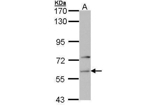 Phenylalanyl-tRNA Synthetase, alpha Subunit (FARSA) anticorps