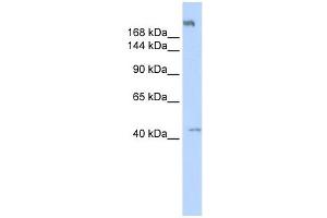 POLR3A antibody used at 1 ug/ml to detect target protein. (POLR3A anticorps  (Middle Region))