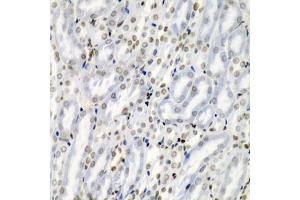 Immunohistochemistry of paraffin-embedded mouse kidney using TNFSF10 antibody (ABIN3023014, ABIN3023015, ABIN3023016 and ABIN6219347) at dilution of 1:200 (40x lens).