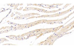 Detection of TPSb2 in Mouse Cardiac Muscle Tissue using Polyclonal Antibody to Tryptase Beta 2 (TPSb2)