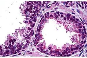 anti-Homeodomain Interacting Protein Kinase 2 (HIPK2) (AA 961-1065) antibody
