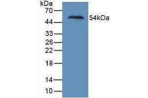 Figure. (HAVCR1 anticorps  (AA 21-240))