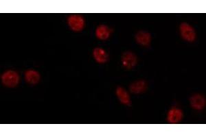ABIN6266786 staining HT29 by IF/ICC. (MED17 anticorps  (Internal Region))