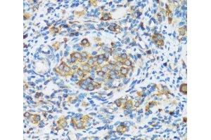 Immunohistochemistry of paraffin-embedded Rat ovary using APOBEC3F Polyclonal Antibody at dilution of 1:100 (40x lens). (APOBEC3F anticorps)