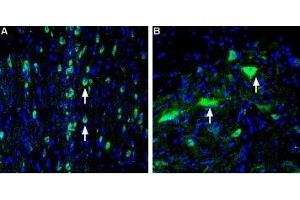 Expression of VAChT in rat medial septum and spinal cord - Immunohistochemical staining of perfusion-fixed frozen rat brain sections using Anti-Vesicular Acetylcholine Transporter (VAChT) Antibody (ABIN7043686, ABIN7044219 and ABIN7044220), (1:400), followed by goat-anti-rabbit-AlexaFluor-488. (SLC18A3 anticorps  (C-Term, Cytosolic))