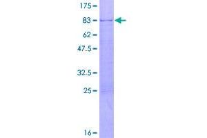 Image no. 1 for SWI/SNF Related, Matrix Associated, Actin Dependent Regulator of Chromatin, Subfamily D, Member 3 (SMARCD3) (AA 1-470) protein (GST tag) (ABIN1320644)