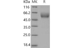 Western Blotting (WB) image for Single Immunoglobulin and Toll-Interleukin 1 Receptor (TIR) Domain (SIGIRR) protein (His tag,Fc Tag) (ABIN7198052)