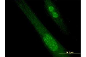 Immunofluorescence of purified MaxPab antibody to SPANXB1 on Hs 181.