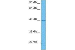 Host:  Mouse  Target Name:  PCBP1  Sample Tissue:  Mouse Brain  Antibody Dilution:  1ug/ml (PCBP1 anticorps  (Middle Region))
