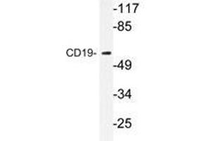 Western blot analysis of CD19 antibody in extracts from COS7 cells. (CD19 anticorps)