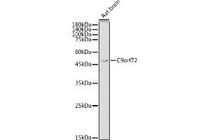 Western blot analysis of extracts of Rat brain, using C9orf72 antibody (ABIN7266391) at 1:1000 dilution. (C9ORF72 anticorps  (AA 1-230))