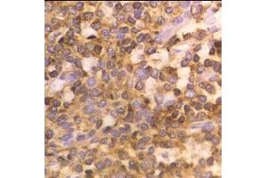 HLA Class 1 staining (ABIN118900) on Human tonsil. (HLA-ABC anticorps)