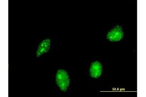 Immunofluorescence of monoclonal antibody to HIC1 on HeLa cell. (HIC1 anticorps  (AA 396-453))