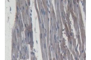 Detection of MMP9 in Rat Cardiac Muscle Tissue using Monoclonal Antibody to Matrix Metalloproteinase 9 (MMP9)