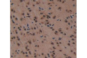 IHC-P analysis of Kidney tissue, with DAB staining. (HSF4 anticorps  (AA 159-411))