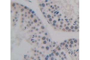 IHC-P analysis of Human Tissue, with DAB staining.