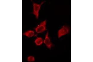 ABIN6276159 staining HeLa by IF/ICC.