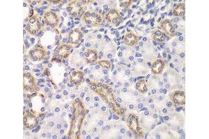 Immunohistochemistry of paraffin-embedded Rat kidney using KEAP1 Polyclonal Antibody at dilution of 1:100 (40x lens). (KEAP1 anticorps)